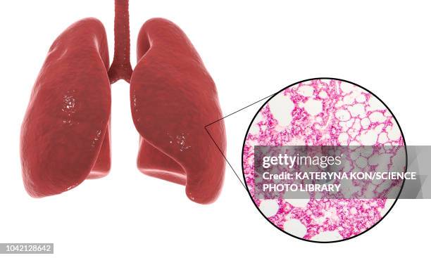 human lung anatomy and histology, illustration - 光学顕微鏡図点のイラスト素材／クリップアート素材／マンガ素材／アイコン素材
