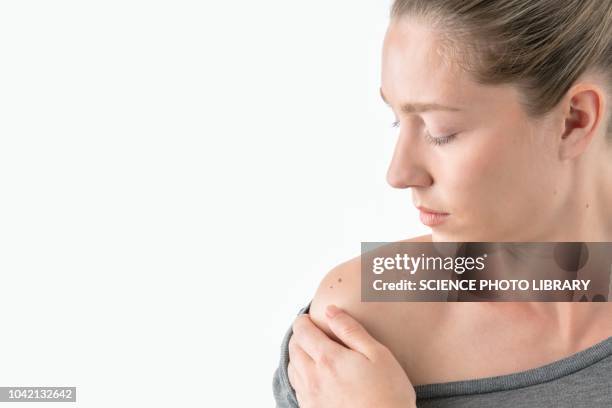 woman checking moles on shoulder - melanoma stock pictures, royalty-free photos & images