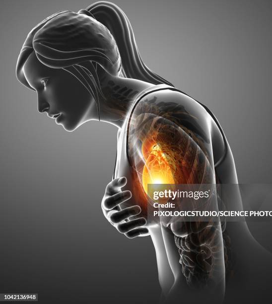 woman with chest pain, illustration - heartburn stock illustrations