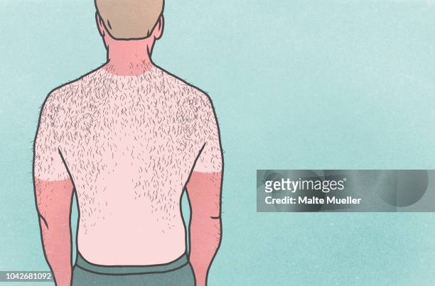sunburned man with hairy back on blue background - behaart stock-fotos und bilder