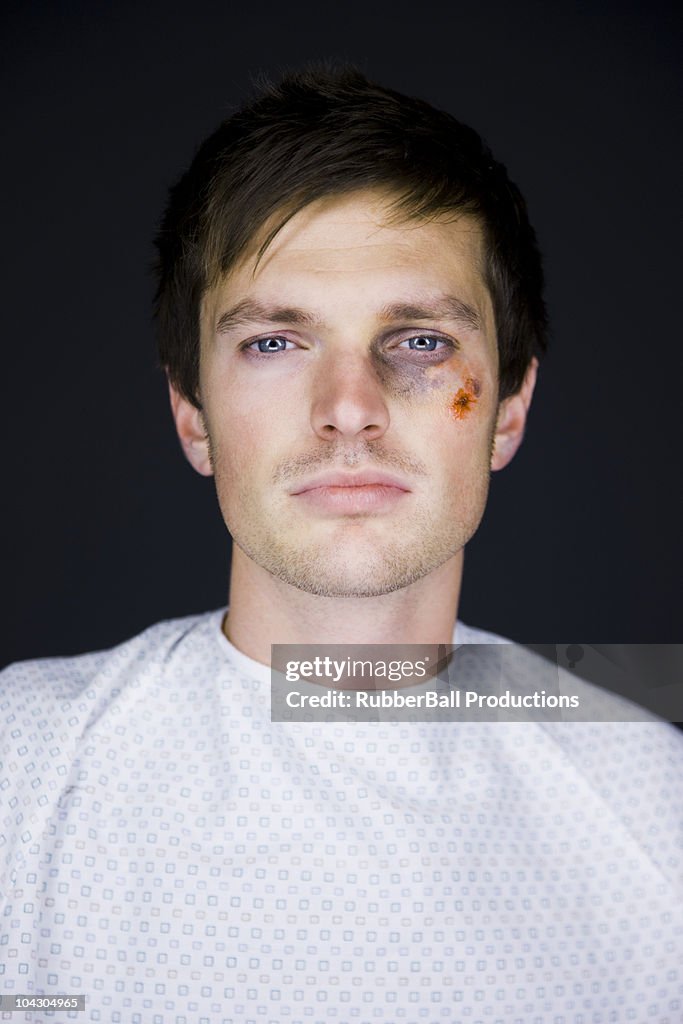 Hospital patient with a black eye