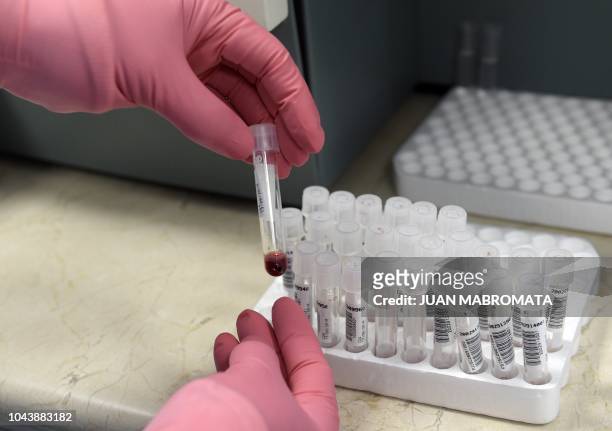 PhD student tests blood samples in the lab of the Institute of Biomedical Research in Retroviruses and AIDS , of the CONICET and Buenos Aires...