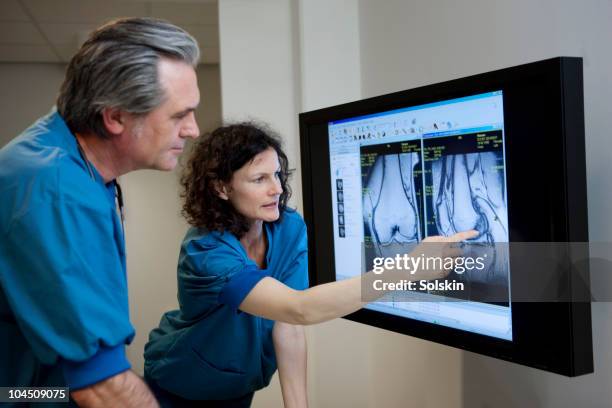 doctors looking at mr image of knee - knees together - fotografias e filmes do acervo