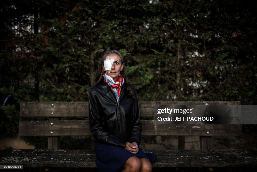 FRANCE-GOLF-RYDER-ACCIDENT-PORTRAIT