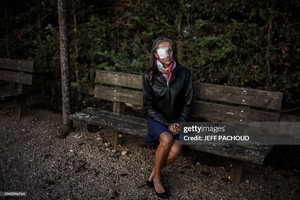 FRANCE-GOLF-RYDER-ACCIDENT-PORTRAIT