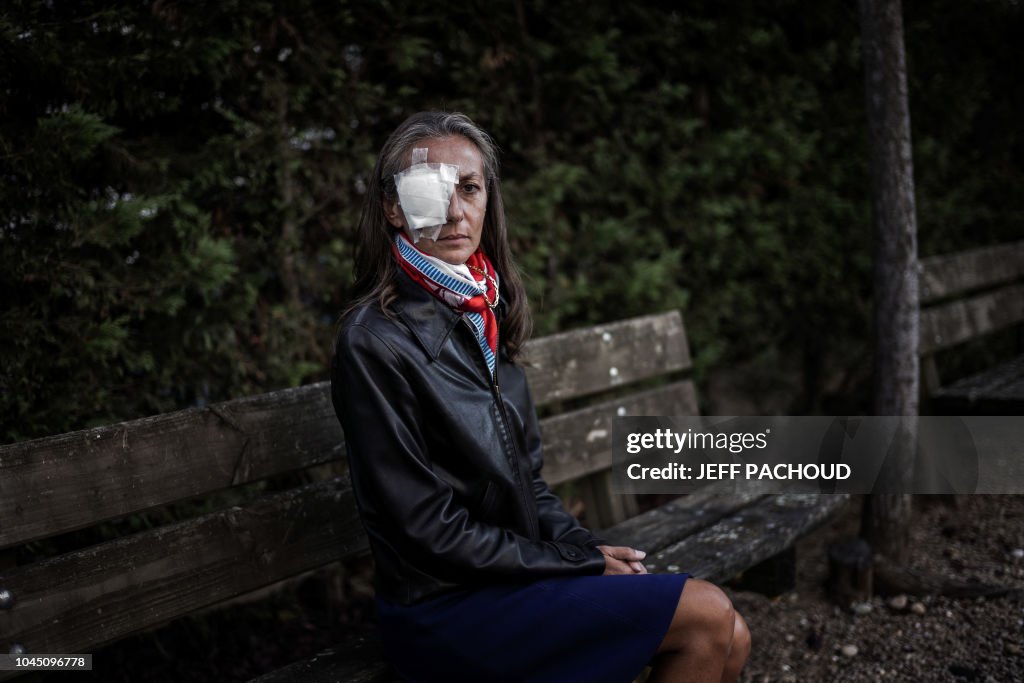 FRANCE-GOLF-RYDER-ACCIDENT-PORTRAIT