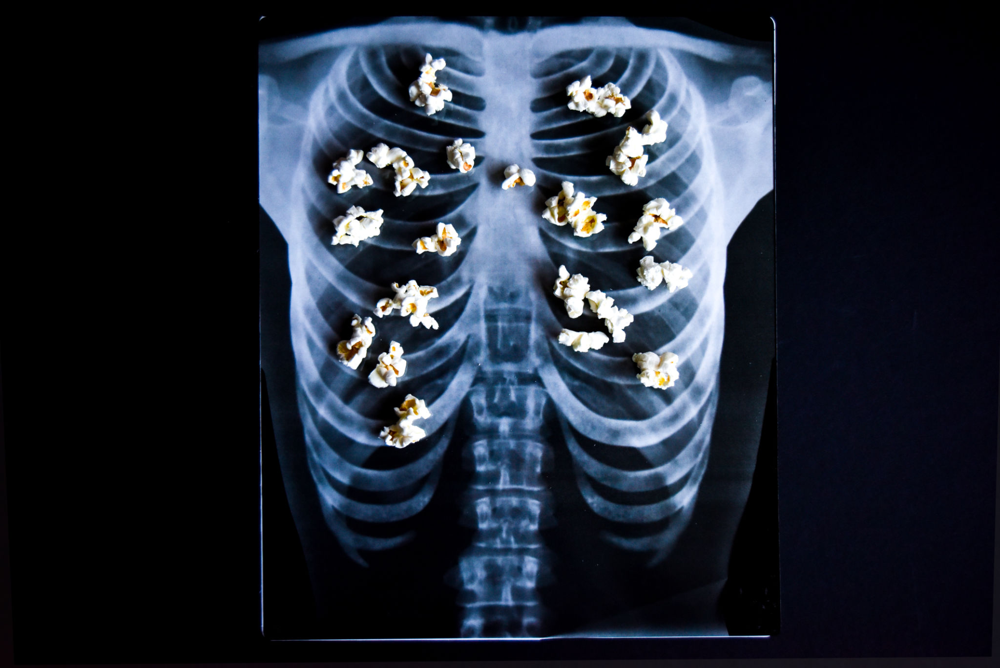 popcorn lung concept