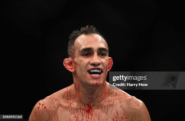 Tony Ferguson looks on while competing against Anthony Pettis in their lightweight bout during the UFC 229 event inside T-Mobile Arena on October 6,...