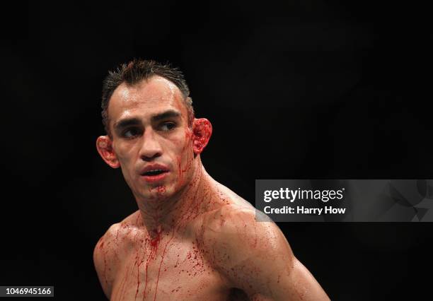Tony Ferguson looks on while competing against Anthony Pettis in their lightweight bout during the UFC 229 event inside T-Mobile Arena on October 6,...