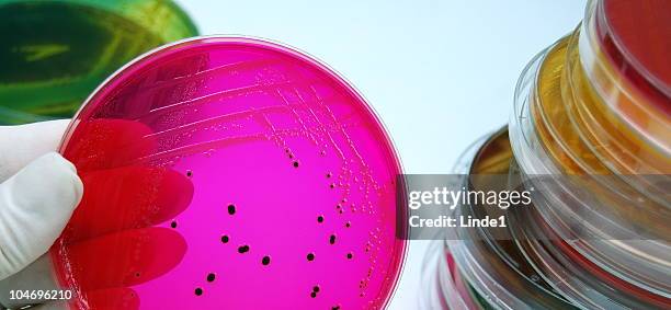 salmonella - salmonella stock pictures, royalty-free photos & images