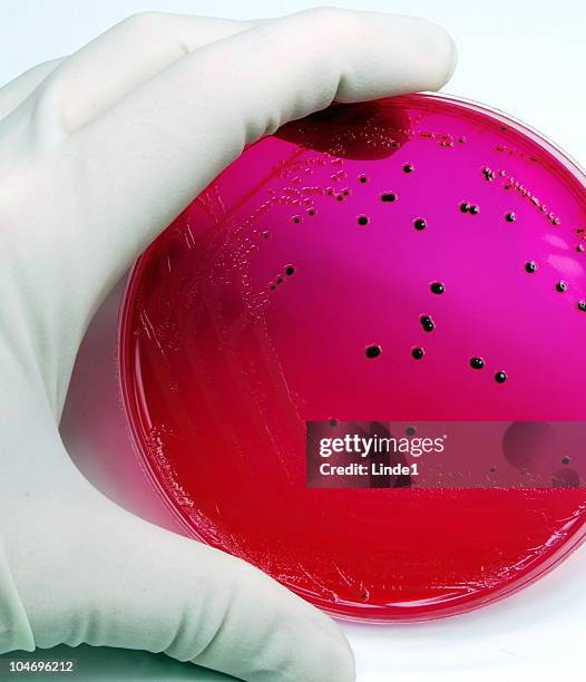 salmonella - salmonella bacterium stock pictures, royalty-free photos & images