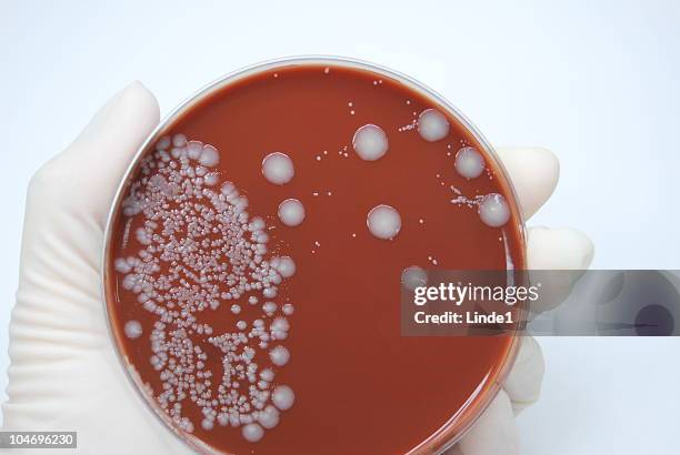 Lab Coli Scope 134 E Coli Under A Microscope Stock Photos, High-Res Pictures, and ...