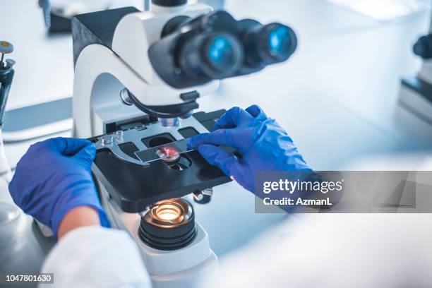 slide de exploração cientista com amostra de sangue em laboratório - lâmina-de-microscópio - fotografias e filmes do acervo