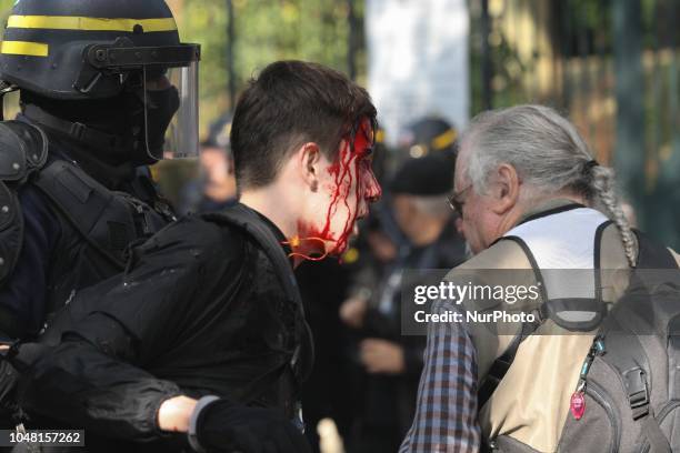 The face of a demonstrator is injured during a rally called by several French workers unions on October 9, 2018 in Paris as part of a nationwide day...