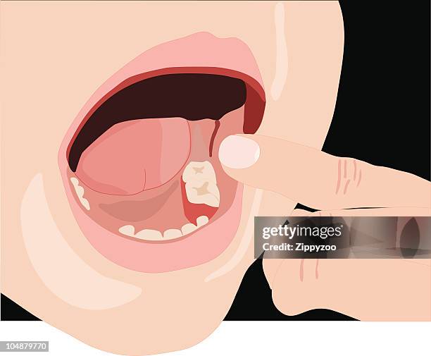 missing tooth (vector) - chin stock illustrations