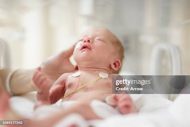premature baby girl in incubator - premature 個照片及圖片檔