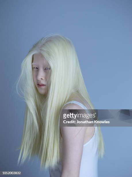 albino chinese teenage girl - moue de dédain photos et images de collection