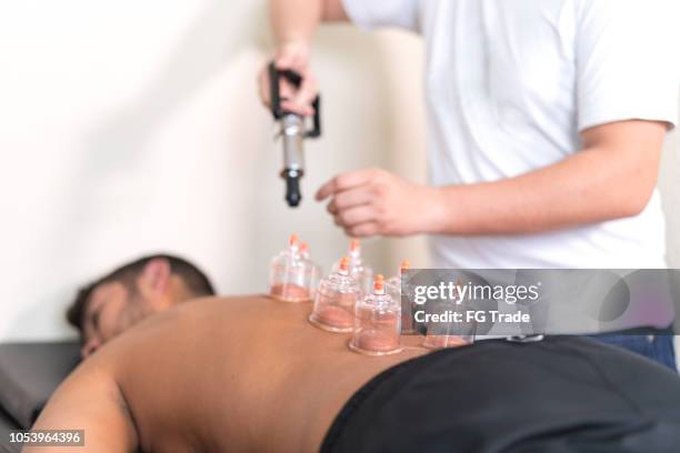 applying cupping therapy in traditional chinese medicine on man back - vacuum packed stock pictures, royalty-free photos & images