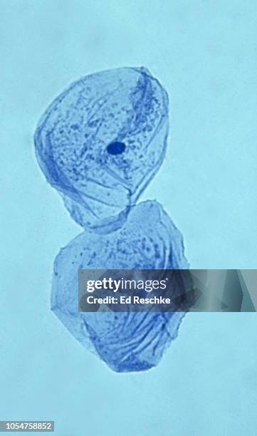 cell structure of an animal cell--cheek or epithelial cells from the oral cavity, 100x - cellulose fotografías e imágenes de stock