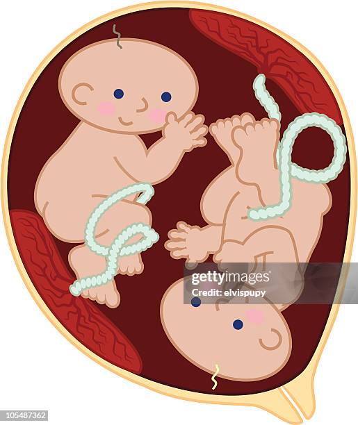 ilustraciones, imágenes clip art, dibujos animados e iconos de stock de los fetos con camas gemelas - cuidado prenatal