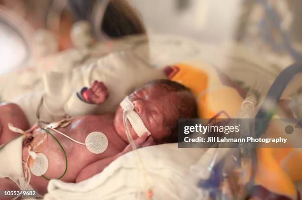 29 week premature baby is seen in hospital with medical equipment - prematuro imagens e fotografias de stock
