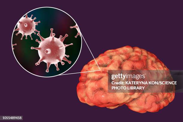 brain infection caused by herpes viruses, illustration - herpes stock-grafiken, -clipart, -cartoons und -symbole