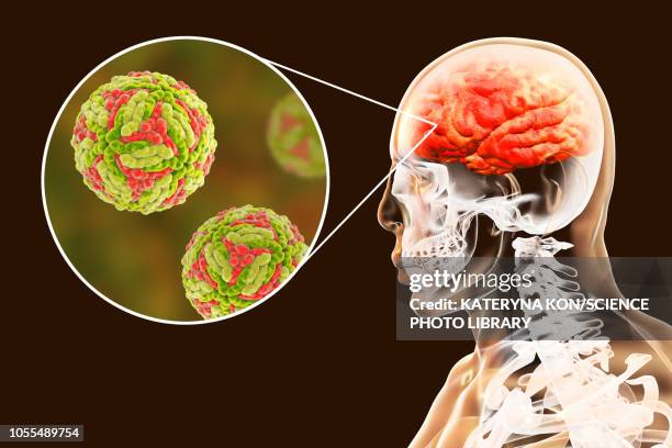 ilustrações de stock, clip art, desenhos animados e ícones de japanese encephalitis, illustration - encefalite