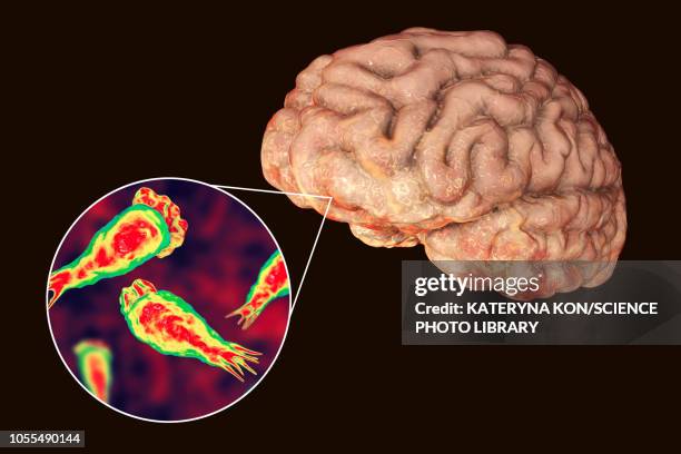 brain-eating amoeba infection, illustration - naegleria fowleri stock illustrations