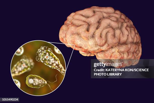 brain-eating amoeba infection, illustration - ameba stock-grafiken, -clipart, -cartoons und -symbole