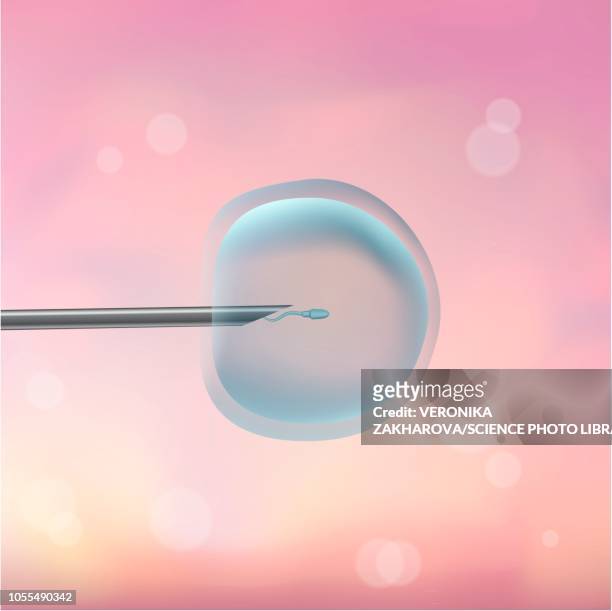 stockillustraties, clipart, cartoons en iconen met icsi in vitro fertilisation, illustration - artificial insemination