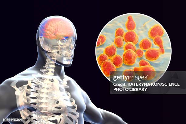fungal meningitis, illustration - meningitis stock-grafiken, -clipart, -cartoons und -symbole