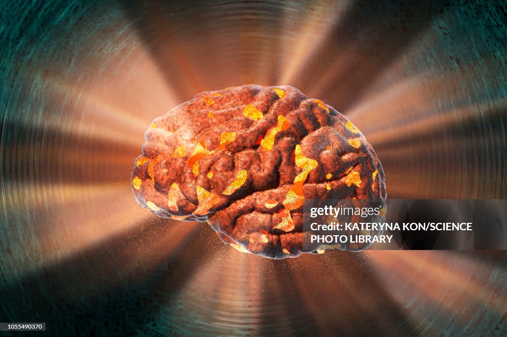 Trivia Brain Exploding Exploding Brain Illustration High-Res Vector Graphic - Getty Images