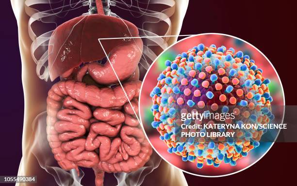 hepatitis c infection, illustration - human small intestine stock illustrations