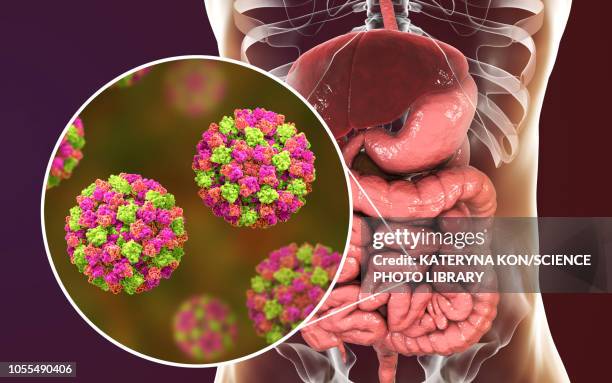 norovirus infection, illustration - gastroenteritis stock illustrations