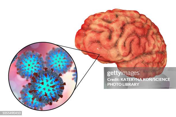 encephalitis caused by measles viruses, illustration - measles stock illustrations