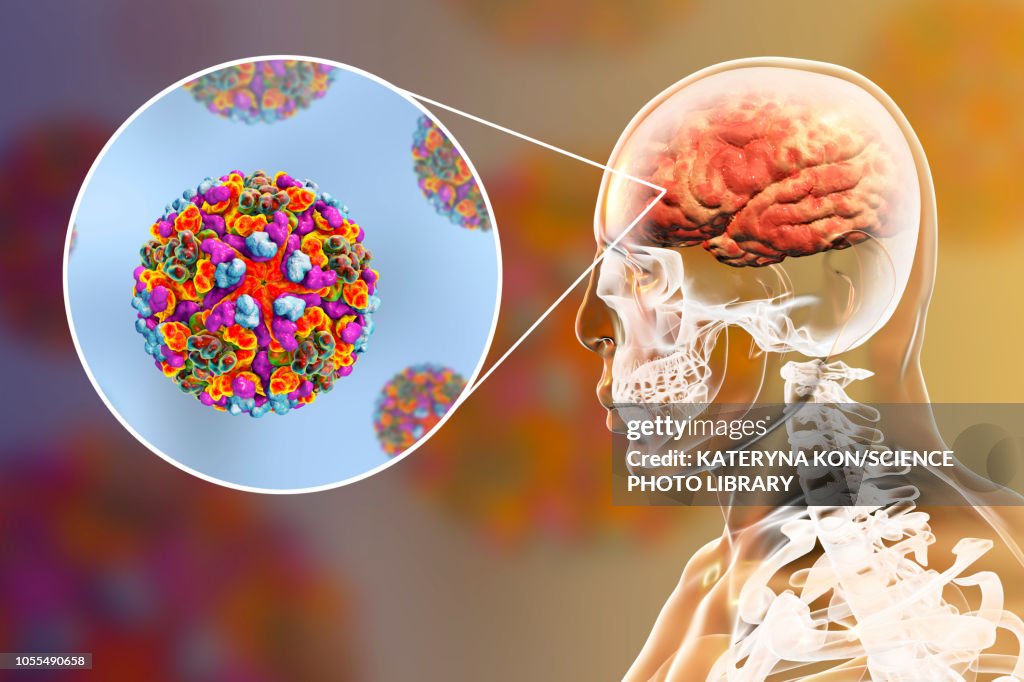 Encephalitis viruses infecting human brain, illustration