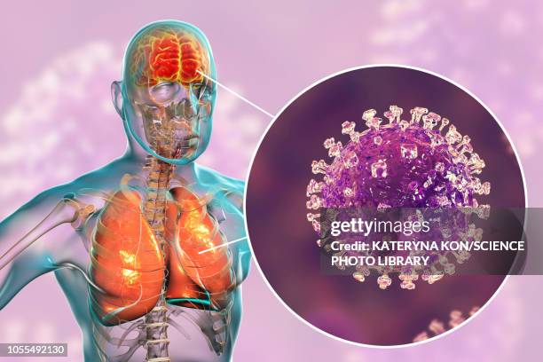 encephalitis caused by nipah viruses, illustration - nipah stock illustrations