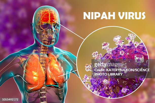 encephalitis caused by nipah viruses, illustration - nipah stock illustrations