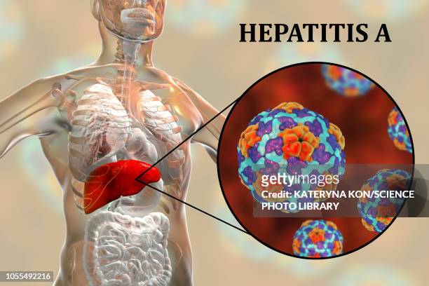 hepatitis a infection, illustration - hepatitis virus stock illustrations