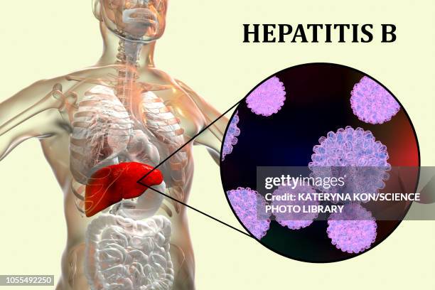 hepatitis b infection, illustration - hepatitis b stock illustrations
