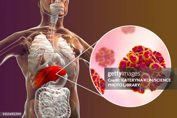 hepatitis e infection, illustration - virus organism stock illustrations