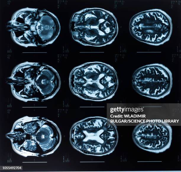 human brain, mri scans - mri scan stock pictures, royalty-free photos & images
