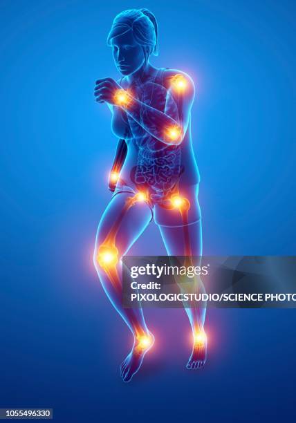 ilustraciones, imágenes clip art, dibujos animados e iconos de stock de woman with joint pain, illustration - esqueleto humano