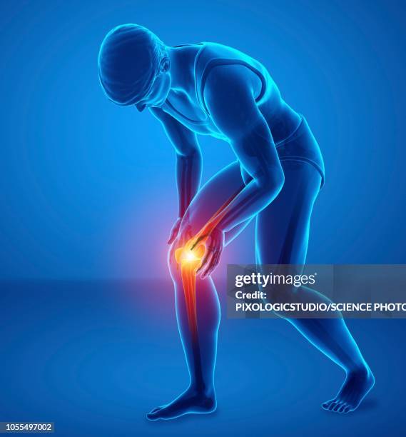 man with knee pain, illustration - joint-body-part stock illustrations