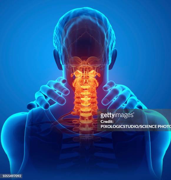 man with neck pain, illustration - neckache stock-grafiken, -clipart, -cartoons und -symbole