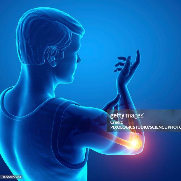 stockillustraties, clipart, cartoons en iconen met man with elbow pain, illustration - elbow