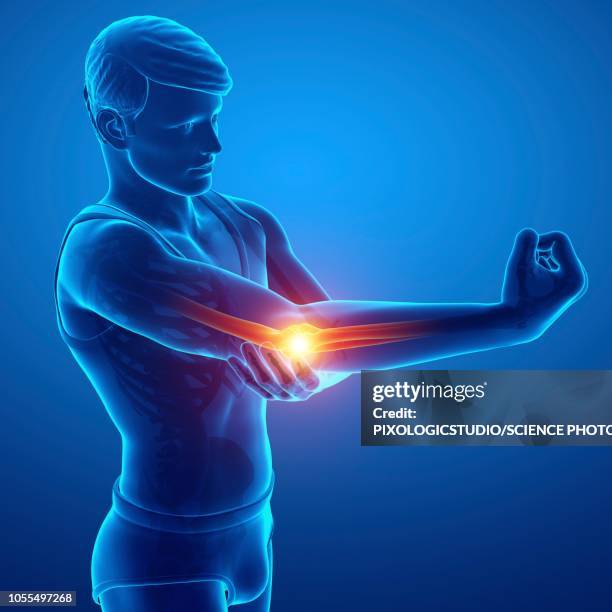 man with elbow pain, illustration - arthritis hand 3d stock illustrations