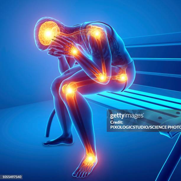 stockillustraties, clipart, cartoons en iconen met man with joint pain, illustration - ontsteking medische aandoening