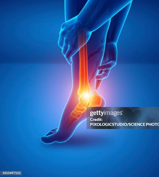 ilustraciones, imágenes clip art, dibujos animados e iconos de stock de man with foot pain, illustration - pie humano