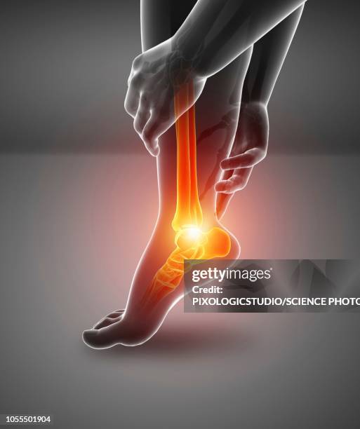 illustrazioni stock, clip art, cartoni animati e icone di tendenza di man with foot pain, illustration - dolore fisico